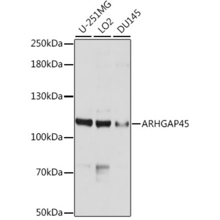 Western Blot - Anti-ARHGAP45 Antibody (A10454) - Antibodies.com