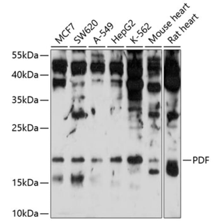 Western Blot - Anti-PDF Antibody (A16794) - Antibodies.com