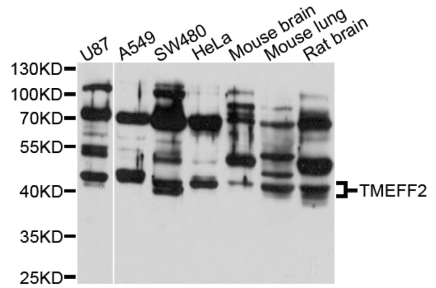 Western Blot - Anti-TMEFF2 Antibody (A10464) - Antibodies.com