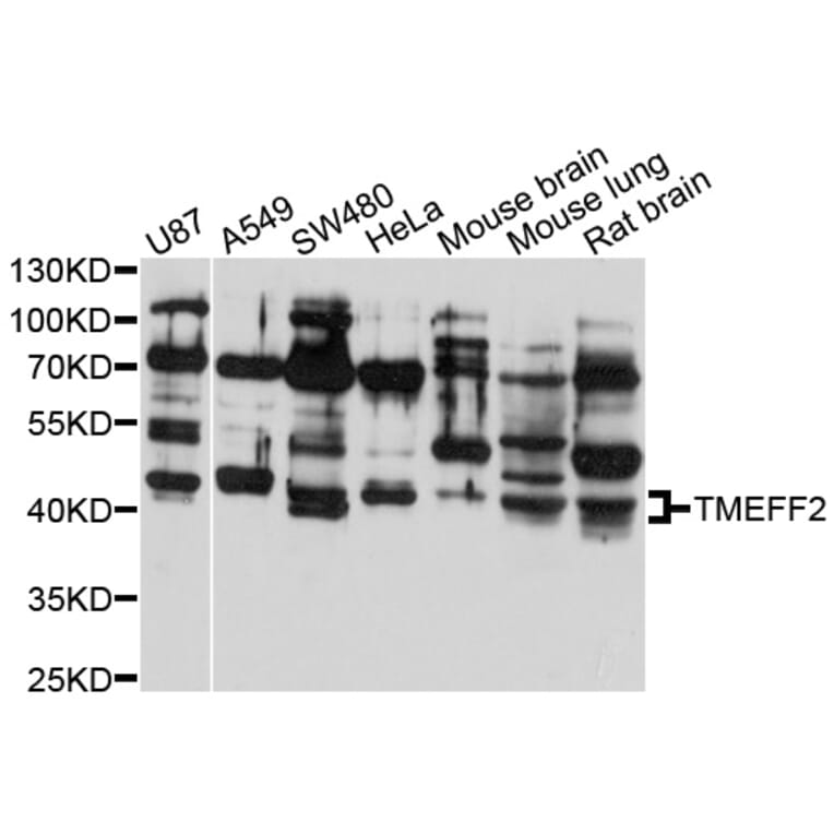 Western Blot - Anti-TMEFF2 Antibody (A10464) - Antibodies.com