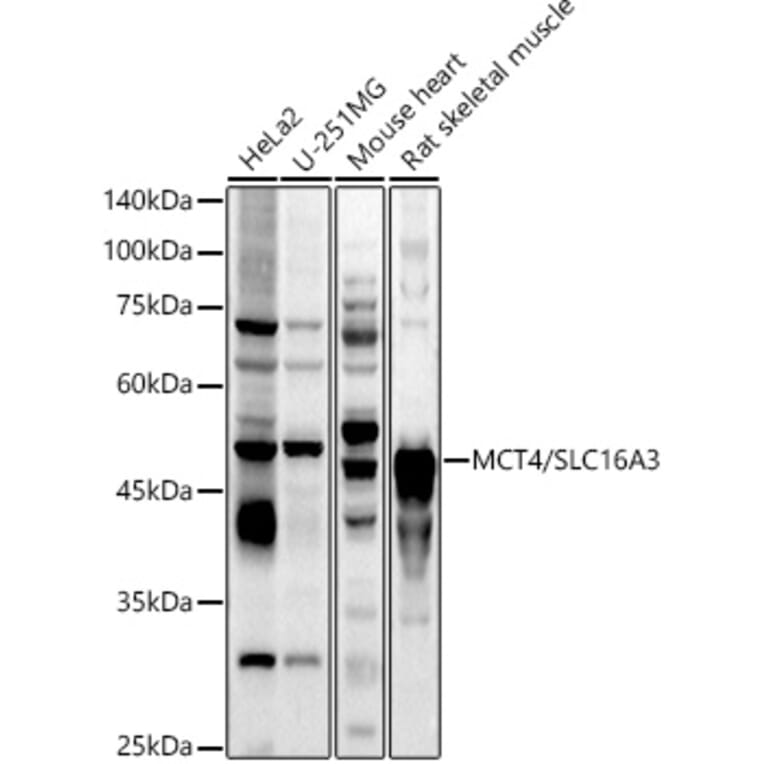 Western Blot - Anti-SLC16A3/MCT 4 Antibody (A16797) - Antibodies.com