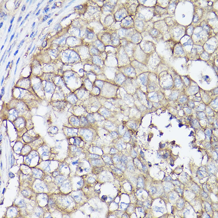 Immunohistochemistry - Anti-SLC16A3/MCT 4 Antibody (A16797) - Antibodies.com