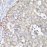 Immunohistochemistry - Anti-SLC16A3/MCT 4 Antibody (A16797) - Antibodies.com