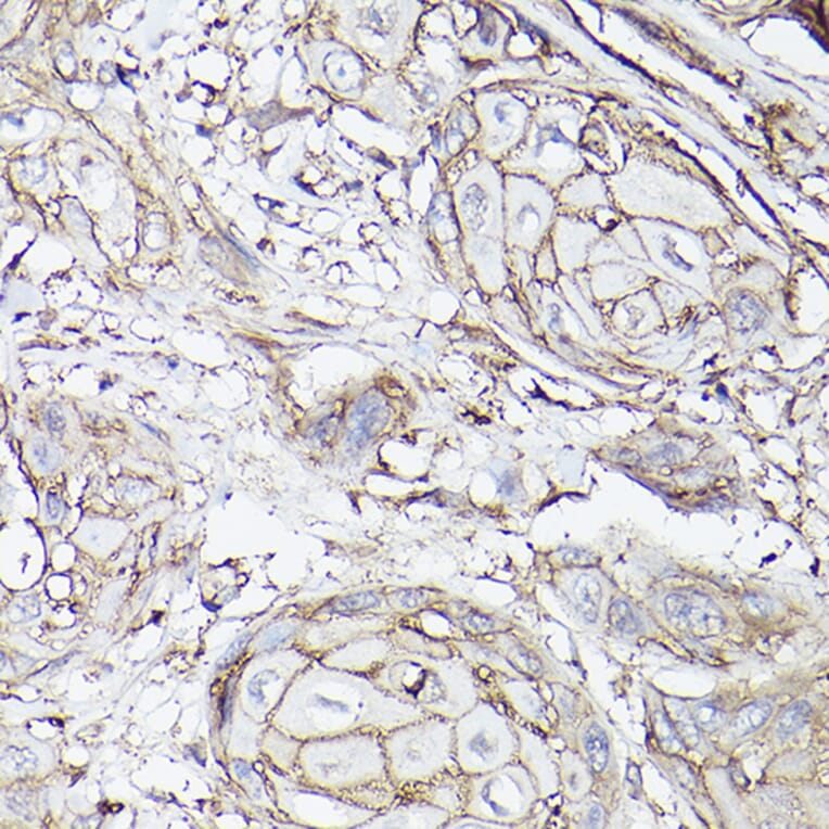 Immunohistochemistry - Anti-SLC16A3/MCT 4 Antibody (A16797) - Antibodies.com