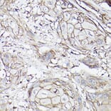 Immunohistochemistry - Anti-SLC16A3/MCT 4 Antibody (A16797) - Antibodies.com