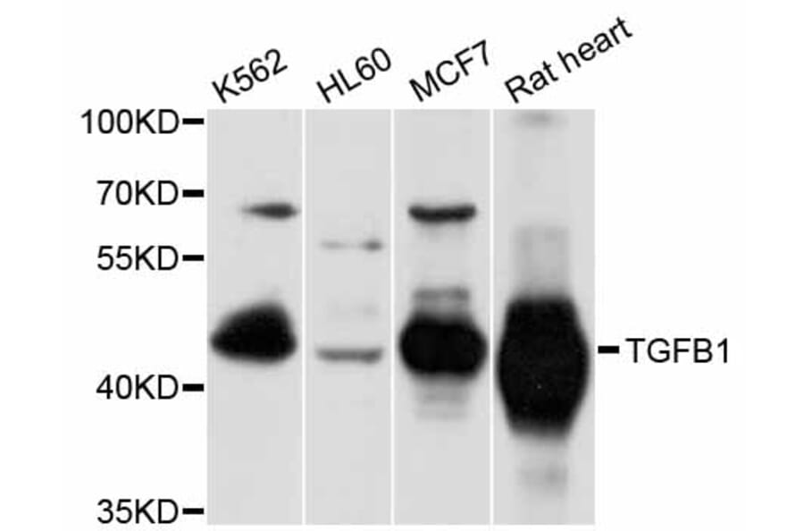 Western Blot - Anti-TGFB1 Antibody (A10749) - Antibodies.com