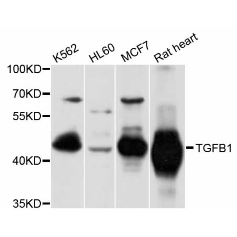 Western Blot - Anti-TGFB1 Antibody (A10749) - Antibodies.com