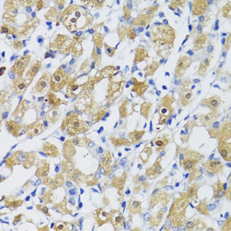 Immunohistochemistry - Anti-TGFB1 Antibody (A10749) - Antibodies.com