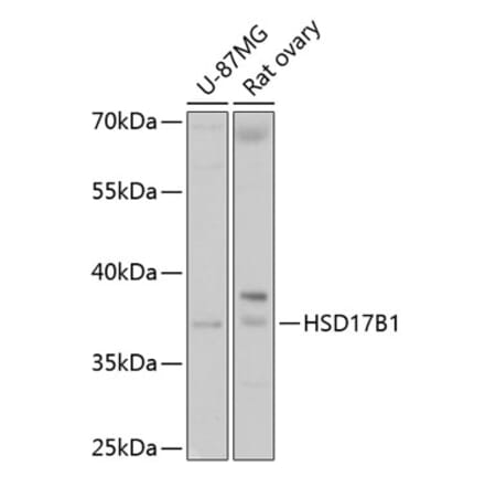 Western Blot - Anti-HSD17B1 Antibody (A16800) - Antibodies.com