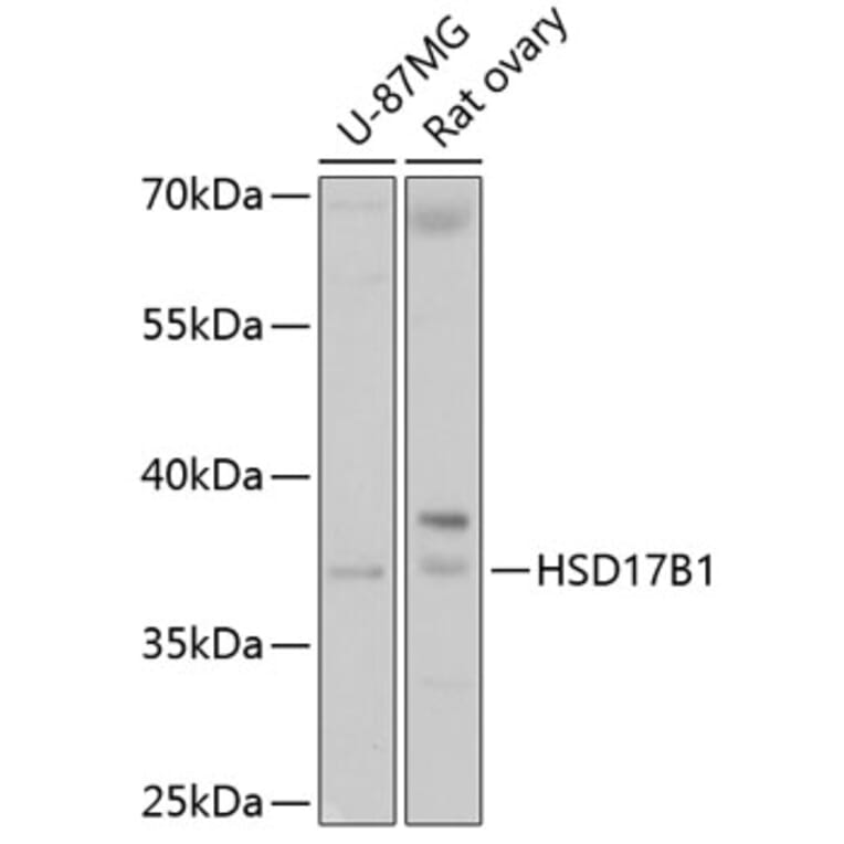 Western Blot - Anti-HSD17B1 Antibody (A16800) - Antibodies.com