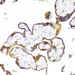 Immunohistochemistry - Anti-HSD17B1 Antibody (A16800) - Antibodies.com