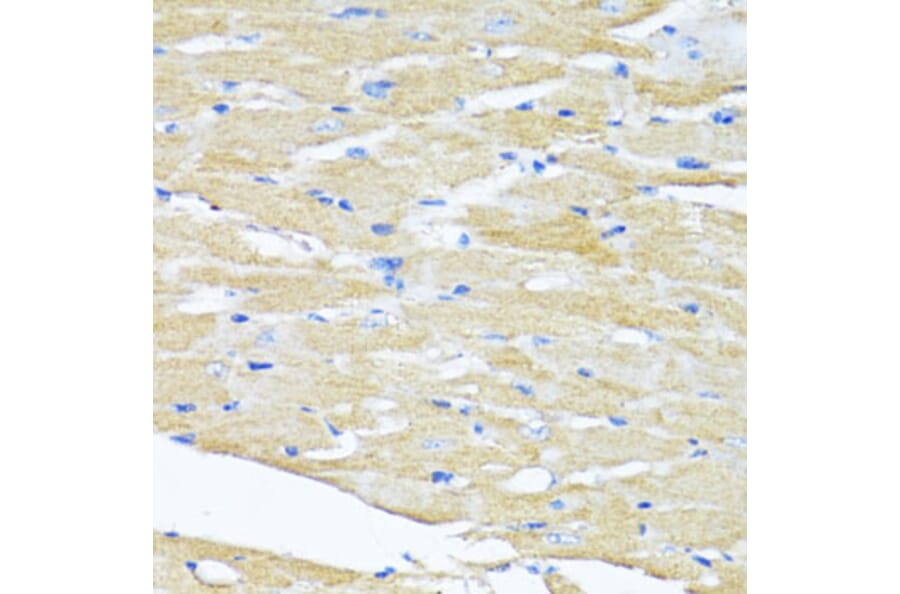 Immunohistochemistry - Anti-HSD17B1 Antibody (A16800) - Antibodies.com