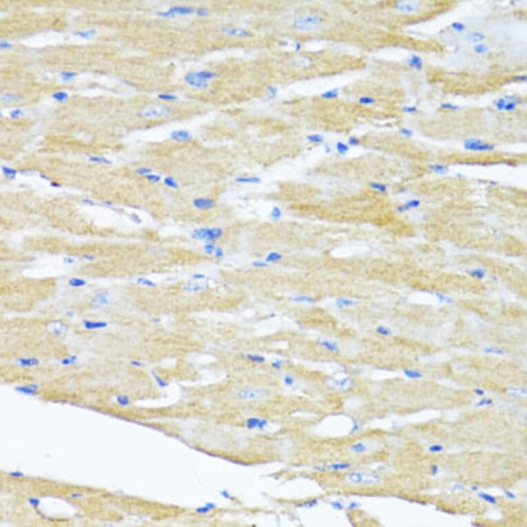 Immunohistochemistry - Anti-HSD17B1 Antibody (A16800) - Antibodies.com