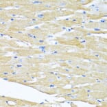 Immunohistochemistry - Anti-HSD17B1 Antibody (A16800) - Antibodies.com