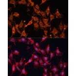 Immunofluorescence - Anti-HSD17B1 Antibody (A16800) - Antibodies.com