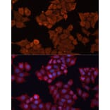 Immunofluorescence - Anti-HSD17B1 Antibody (A16800) - Antibodies.com