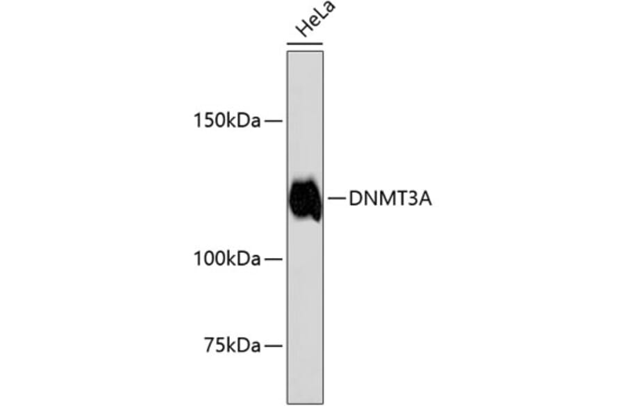 Western Blot - Anti-DNMT3A Antibody (A10844) - Antibodies.com