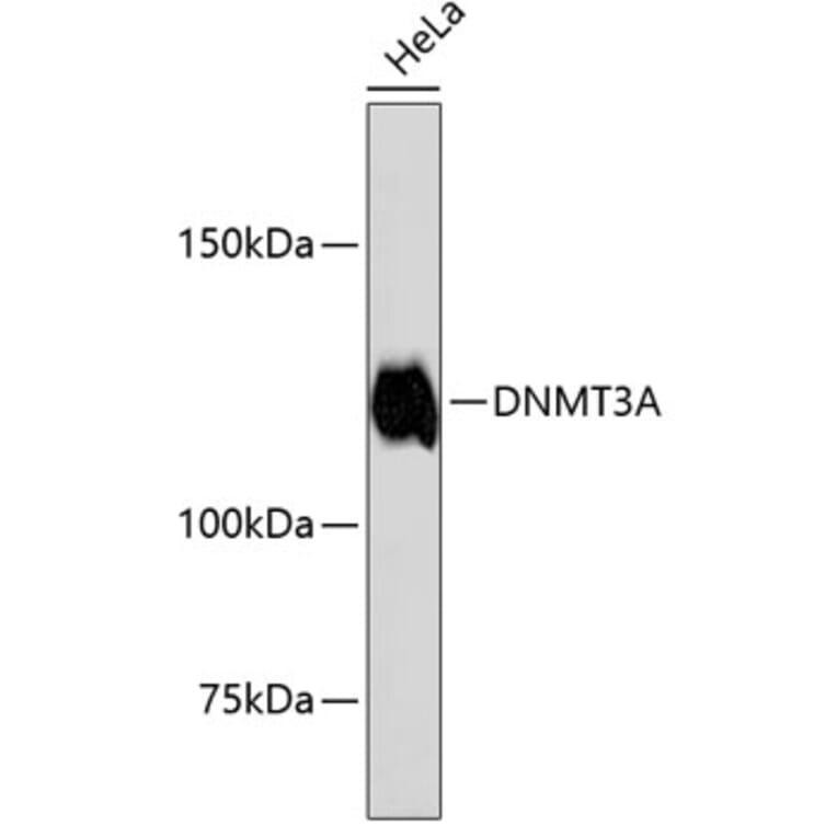 Western Blot - Anti-DNMT3A Antibody (A10844) - Antibodies.com