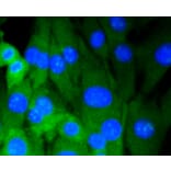 Immunofluorescence - Anti-DNMT3A Antibody (A10844) - Antibodies.com