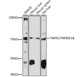 Western Blot - Anti-TNF Receptor II Antibody (A16805) - Antibodies.com