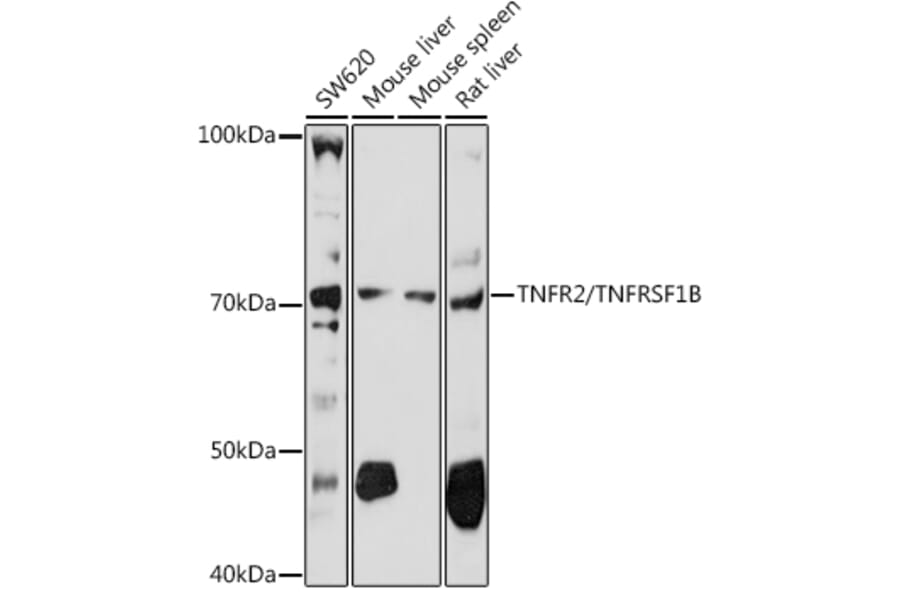 Western Blot - Anti-TNF Receptor II Antibody (A16805) - Antibodies.com