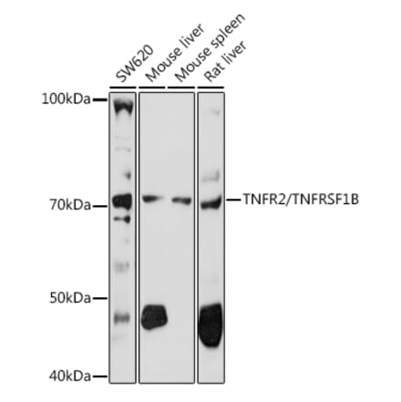 Western Blot - Anti-TNF Receptor II Antibody (A16805) - Antibodies.com