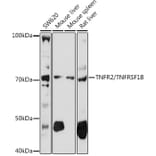 Western Blot - Anti-TNF Receptor II Antibody (A16805) - Antibodies.com