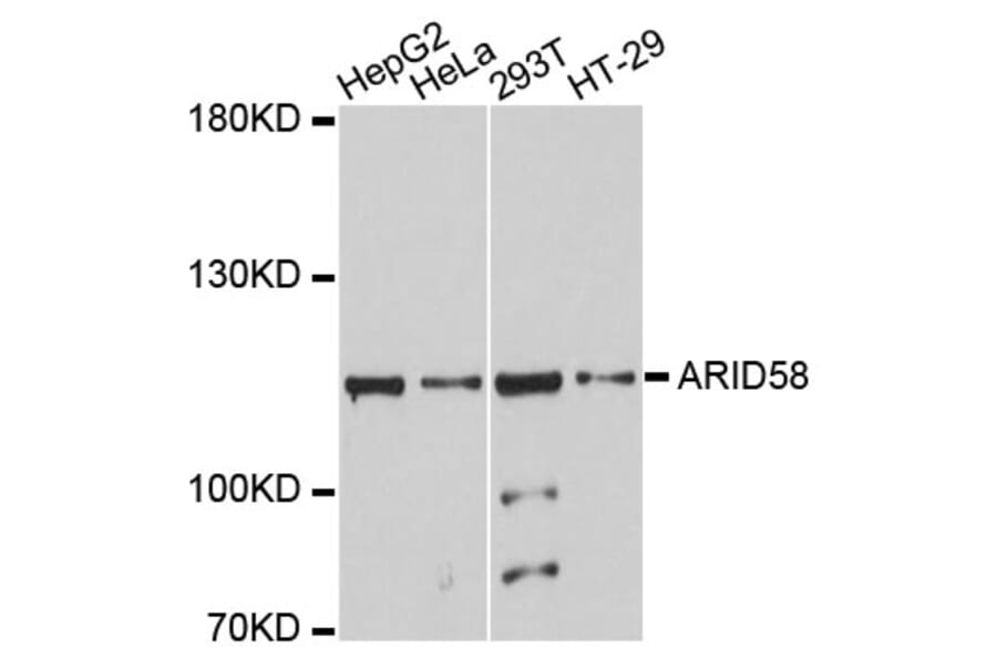 Western Blot - Anti-ARID5B Antibody (A10950) - Antibodies.com