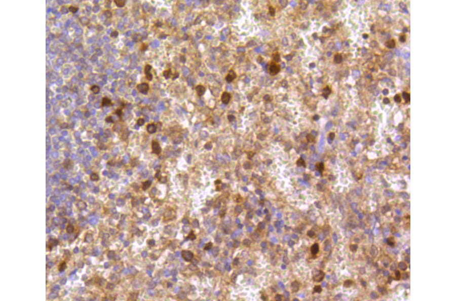 Immunohistochemistry - Anti-CASP3 Antibody (A11024) - Antibodies.com
