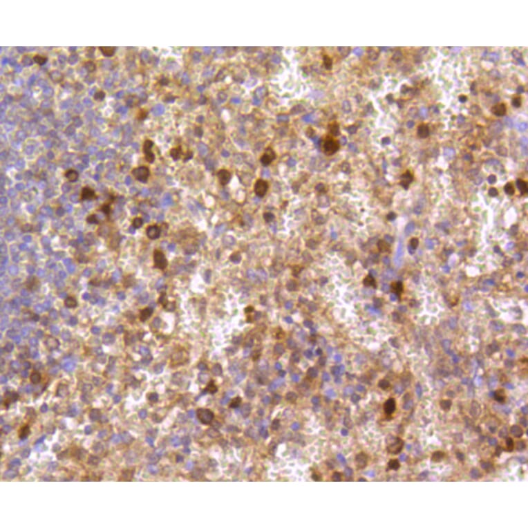 Immunohistochemistry - Anti-CASP3 Antibody (A11024) - Antibodies.com