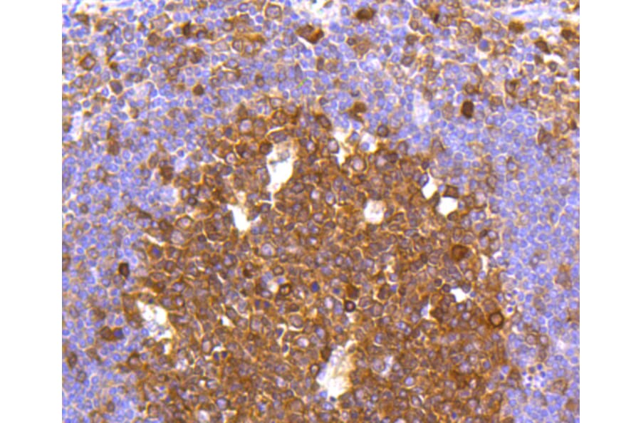 Immunohistochemistry - Anti-CASP3 Antibody (A11024) - Antibodies.com
