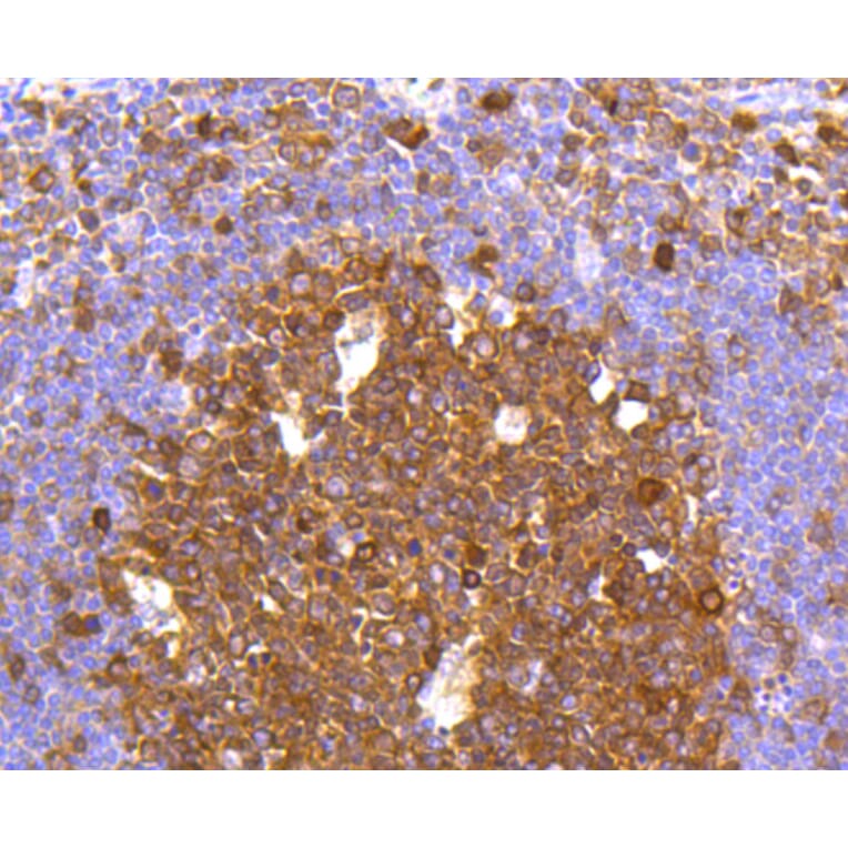 Immunohistochemistry - Anti-CASP3 Antibody (A11024) - Antibodies.com