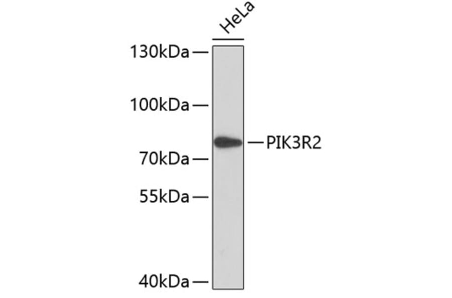 Western Blot - Anti-PIK3R2 Antibody (A11086) - Antibodies.com