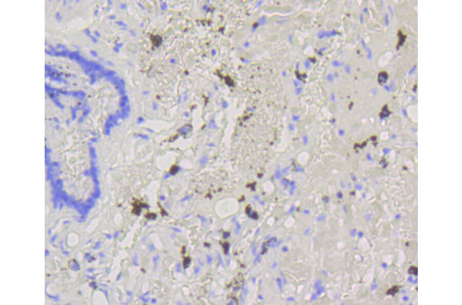 Immunohistochemistry - Anti-ABCG1 Antibody (A11299) - Antibodies.com
