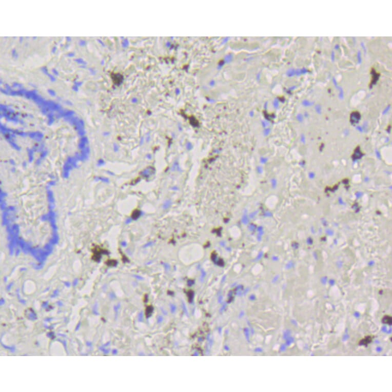 Immunohistochemistry - Anti-ABCG1 Antibody (A11299) - Antibodies.com