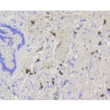 Immunohistochemistry - Anti-ABCG1 Antibody (A11299) - Antibodies.com