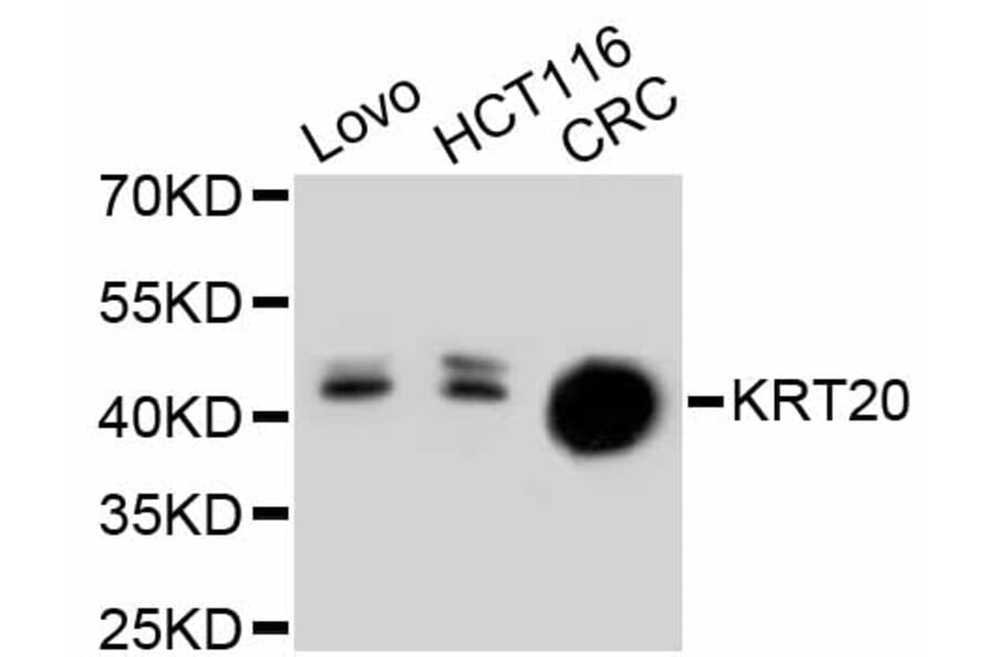 Western Blot - Anti-KRT20 Antibody (A11401) - Antibodies.com
