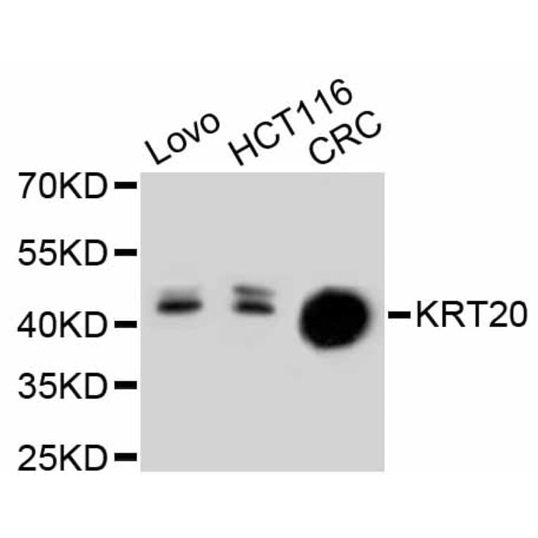Western Blot - Anti-KRT20 Antibody (A11401) - Antibodies.com