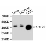 Western Blot - Anti-KRT20 Antibody (A11401) - Antibodies.com