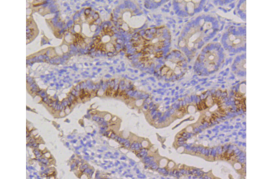 Immunohistochemistry - Anti-KRT20 Antibody (A11401) - Antibodies.com