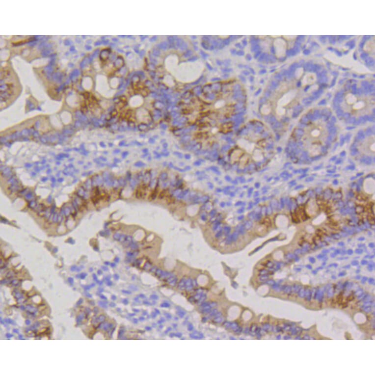 Immunohistochemistry - Anti-KRT20 Antibody (A11401) - Antibodies.com