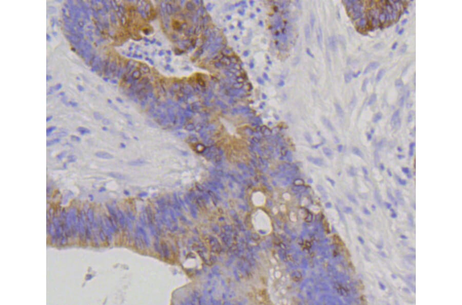 Immunohistochemistry - Anti-KRT20 Antibody (A11401) - Antibodies.com