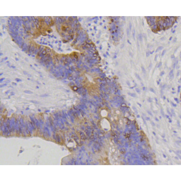 Immunohistochemistry - Anti-KRT20 Antibody (A11401) - Antibodies.com