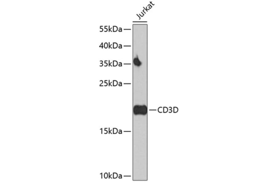 Western Blot - Anti-CD3D Antibody (A16813) - Antibodies.com