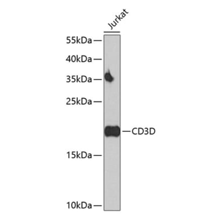 Western Blot - Anti-CD3D Antibody (A16813) - Antibodies.com