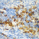 Immunohistochemistry - Anti-CD3D Antibody (A16813) - Antibodies.com