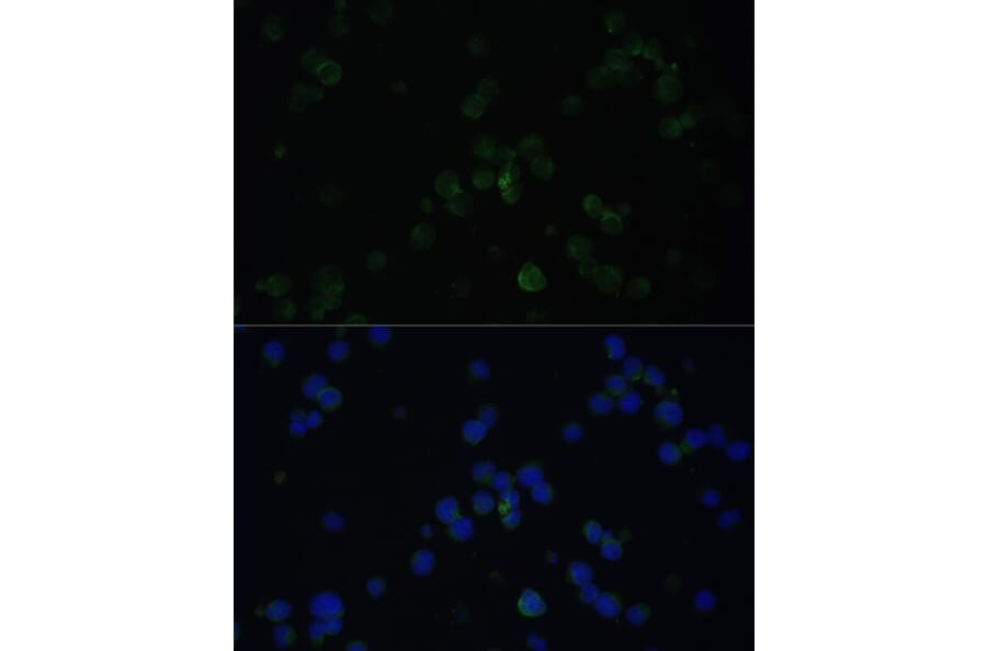 Immunofluorescence - Anti-CD3D Antibody (A16813) - Antibodies.com