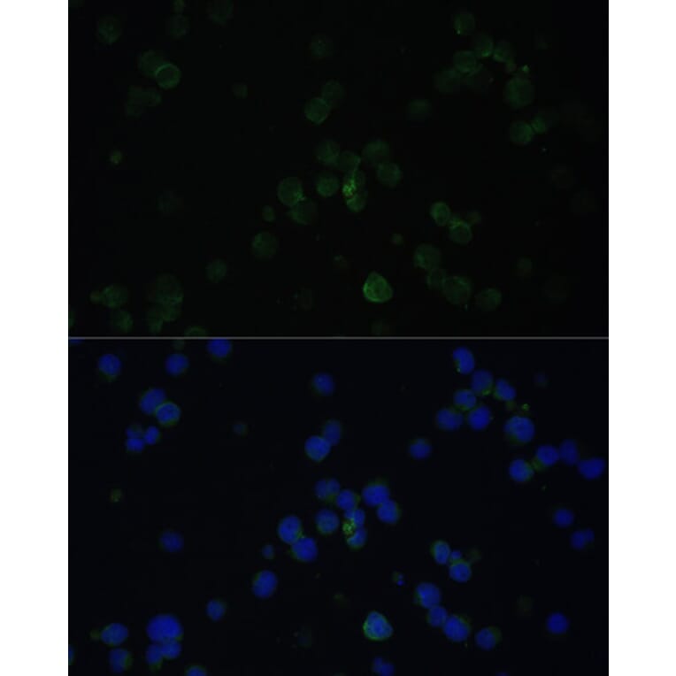 Immunofluorescence - Anti-CD3D Antibody (A16813) - Antibodies.com