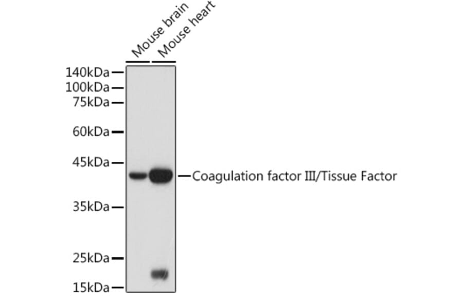 Western Blot - Anti-Tissue Factor Antibody (A16814) - Antibodies.com
