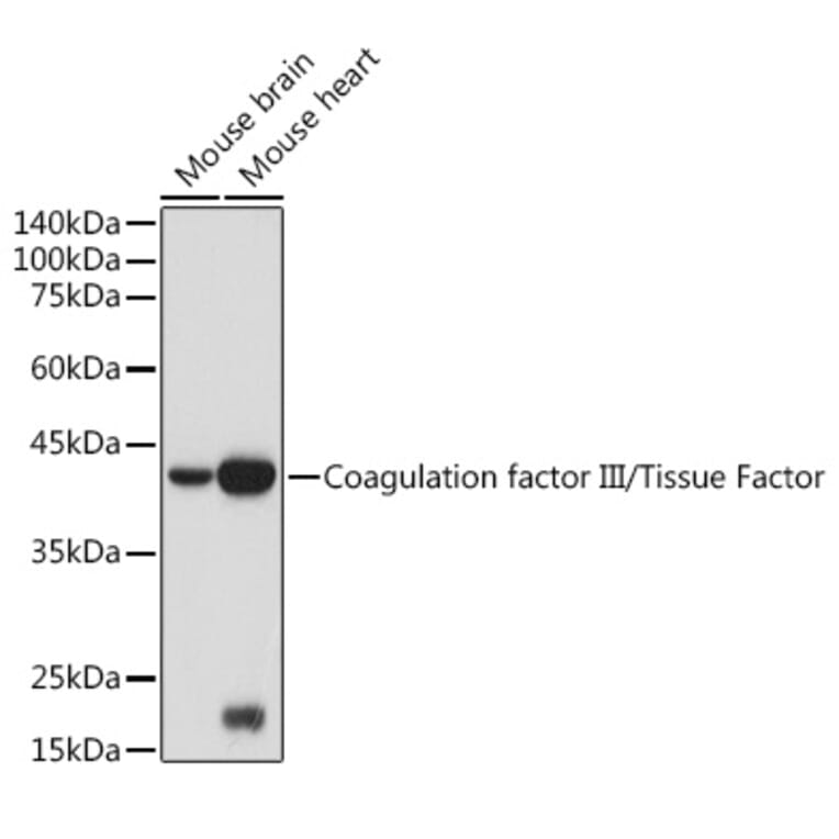 Western Blot - Anti-Tissue Factor Antibody (A16814) - Antibodies.com